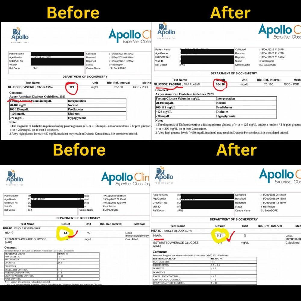 Redacted before/after Apollo Diagnostics lab report showing improved fasting glucose and HbA1c